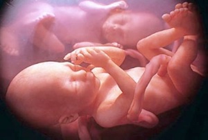 Immagine di ecografia fetale proveniente dal vecchio sito.